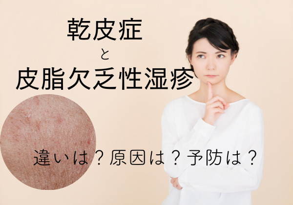 【皮膚科医監修】乾皮症と皮脂欠乏性湿疹の症状・原因と予防・治療