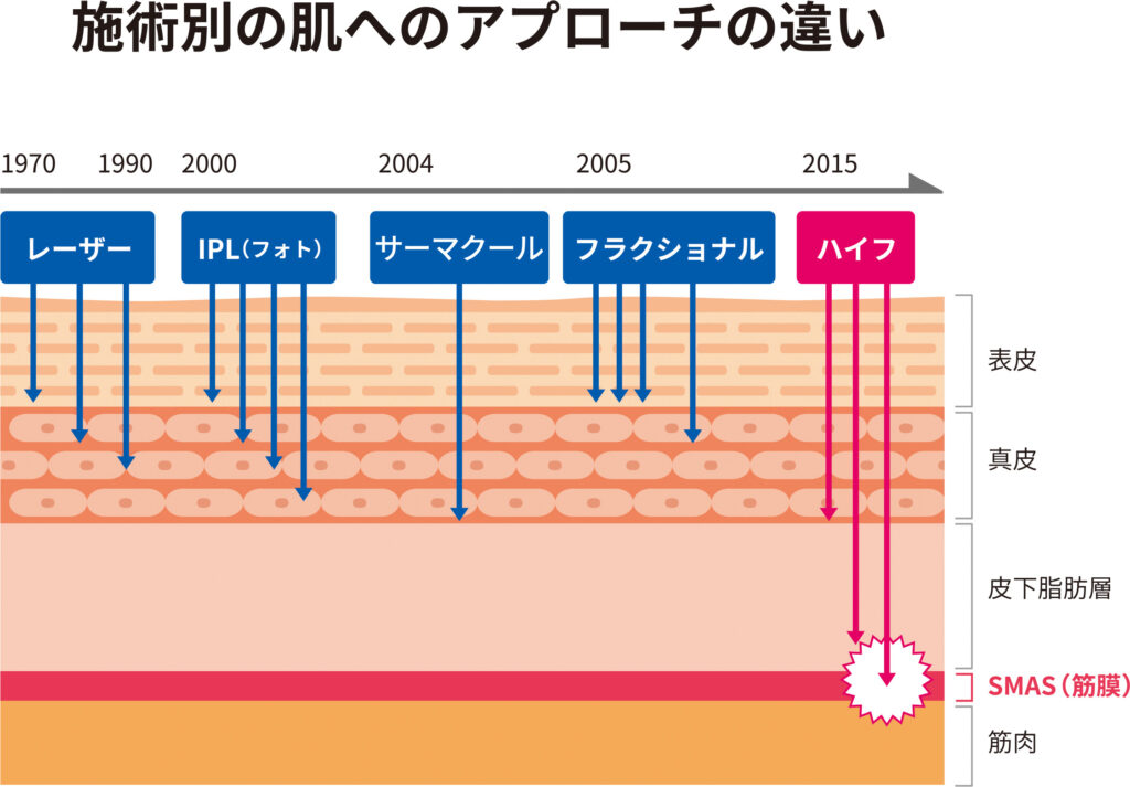 施術別の肌へのアプローチの違い