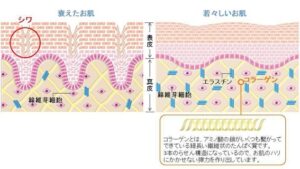衰えた肌と若々しい肌