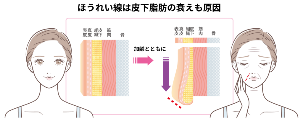 皮下組織の衰えの図
