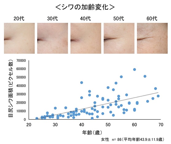 シワの加齢変化