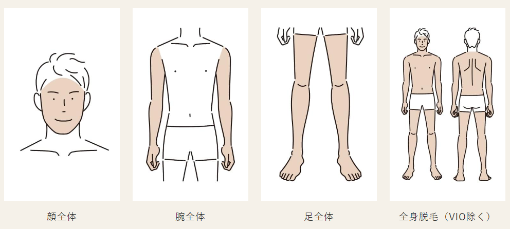 オーシャンズの体脱毛のLパーツ