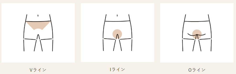 オーシャンズのVIO脱毛の部位