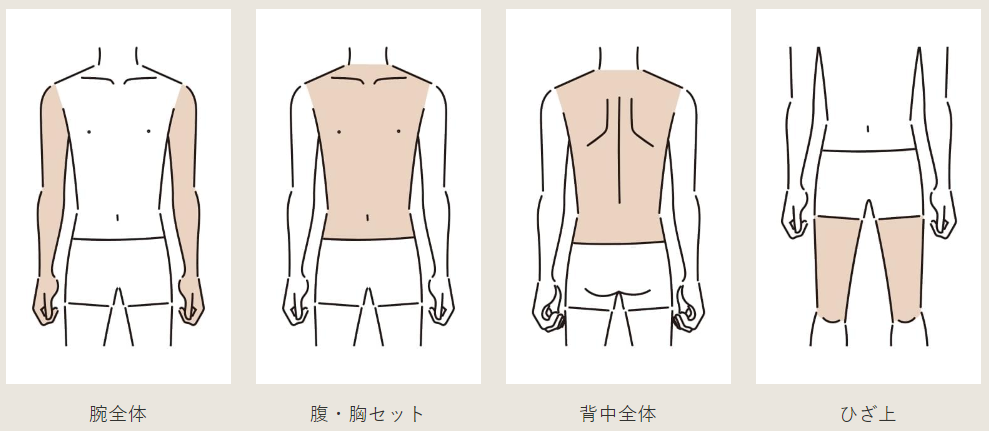 オーシャンズの体脱毛のLパーツ