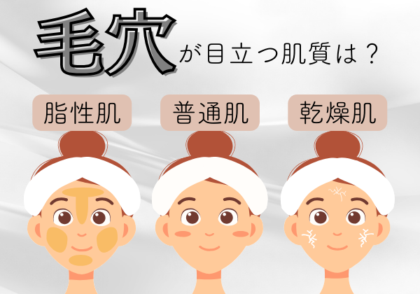 肌質別の女性のイメージ