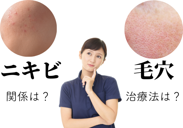 毛穴とニキビは切っても切れない！詰まりと炎症の深い関係と治療法