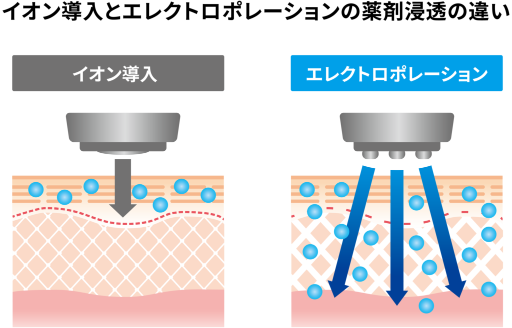 イオン導入とエレクトロポレーションの薬剤浸透の違い