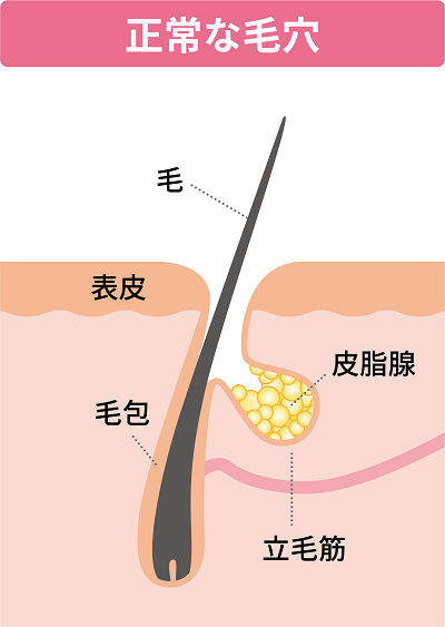 正常な毛穴のイラスト
