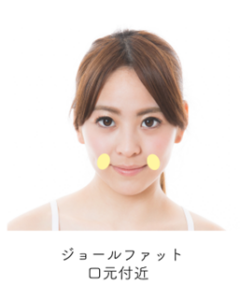 ジョールファット