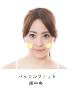 バッカルファット