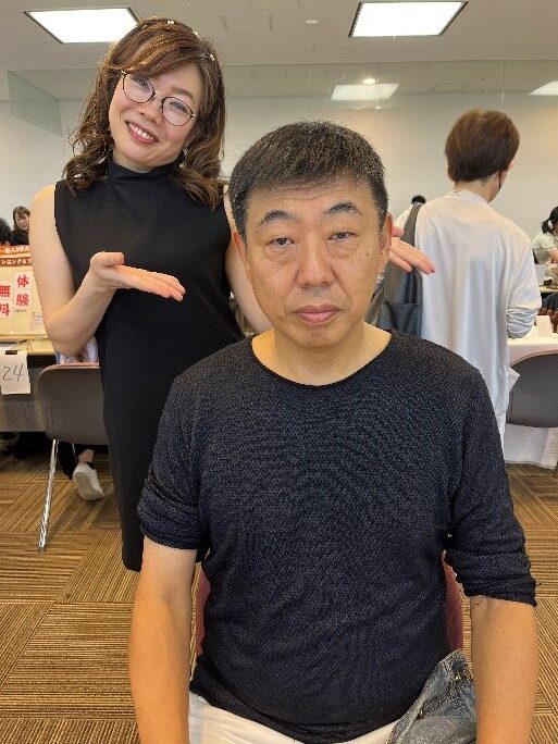 リフトアップ体験の施術後