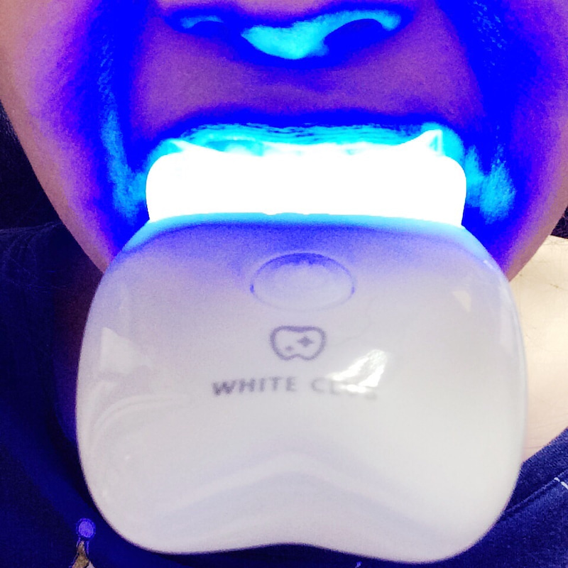 WHITECLUB LED照射器歯のホワイトニング専用照射器・WHITECLUB LED照射器