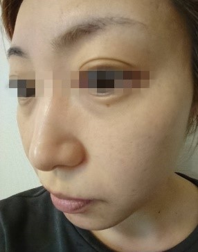 乾燥対策を美容液で行ってこなかった結果