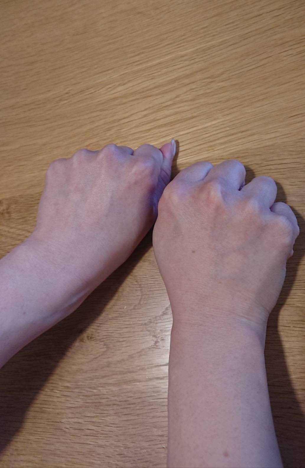 ナールスネオをつけている手と、つけていない手