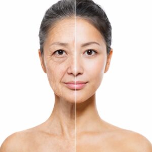 顔の半分が炎症老化した肌のイメージ写真