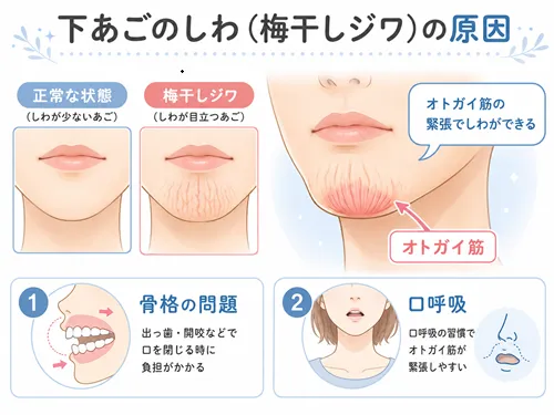 下あごのしわの原因解説