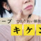テープでほうれい線を消すのは危険！使い方と注意点とは？