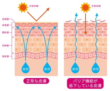 正常な皮膚とバリア機能が低下した皮膚を比較した図