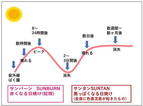 サンバーンとサンタン