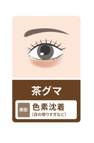 茶グマとその原因