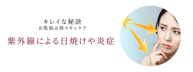 紫外線による日焼けや炎症のお悩み別スキンケア