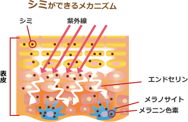 シミができるメカニズム